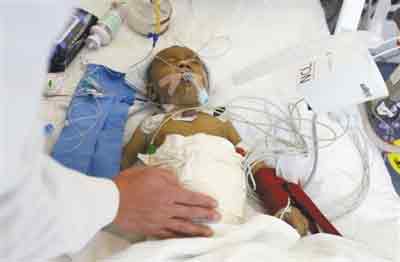 男子拒绝手术 医生自掏腰包也要救